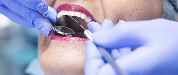 Best Emergency Cosmetic Dentistry (e.g., broken veneers) in Boise City, OK